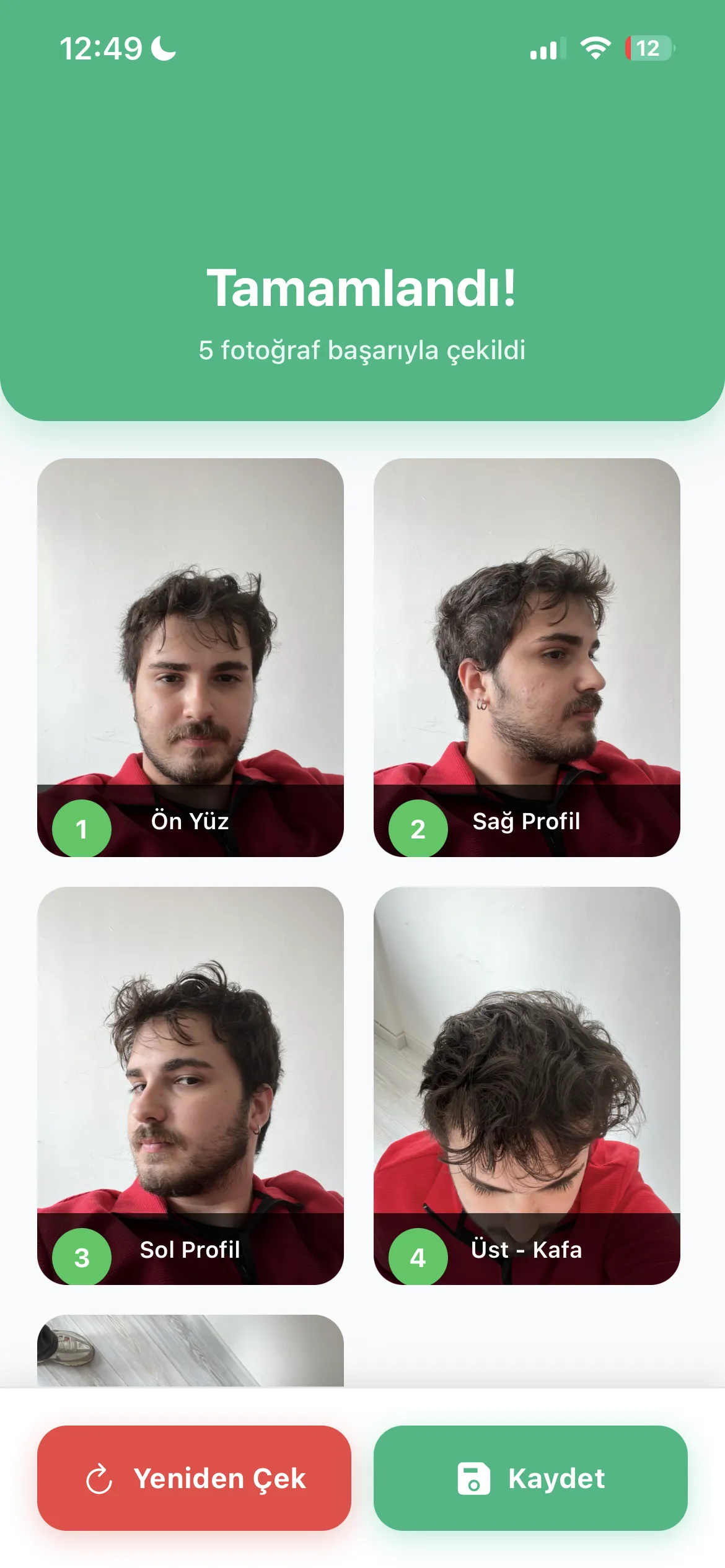 Arka Donör ve tam süreç