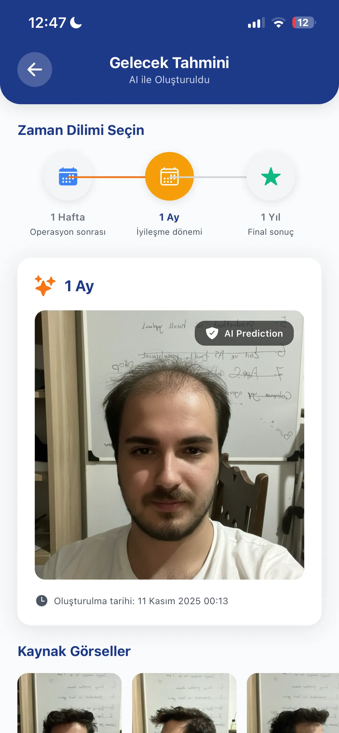 1 Ay Sonrası Tahmini