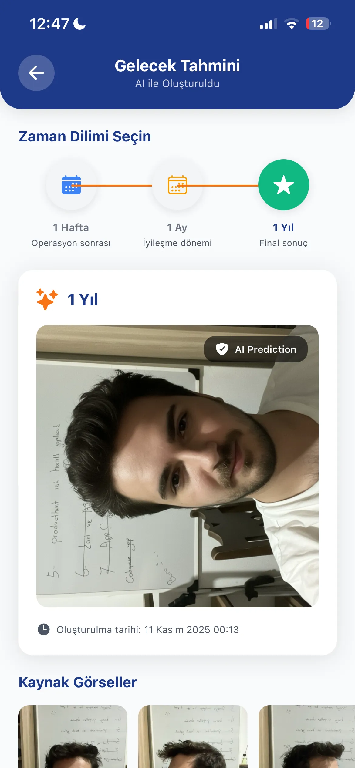 1 Yıl Sonrası Tahmini